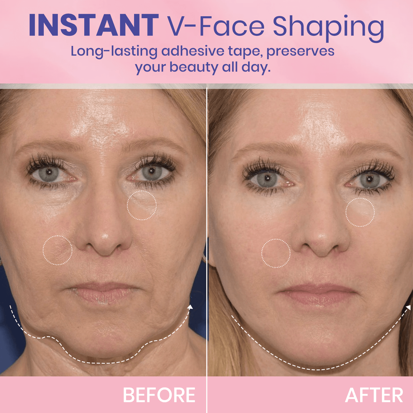 MOONDAR®❤V-Face Lifting Invisible Adhesive 01 Tape 10⚕️