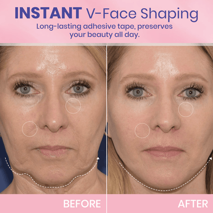 MOONDAR®❤V-Face Lifting Invisible Adhesive 01 Tape 10⚕️