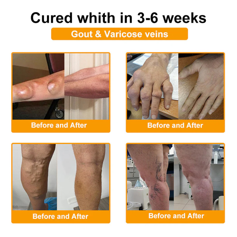 Trilumia® Botulinum Toxin & Bee Venom Pain-Relief Bone Healing Cream🌟⏰50% Off for a Limited Time – Sponsored by Boots