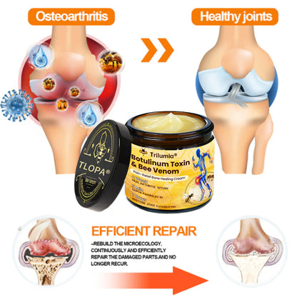 Trilumia® Botulinum Toxin & Bee Venom Pain-Relief Bone Healing Cream🌟⏰50% Off for a Limited Time – Sponsored by Boots