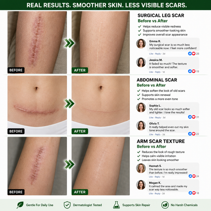 𝗢𝗳𝗳𝗶𝗰𝗶𝗮𝗹 𝘀𝘁𝗼𝗿𝗲  | 𝖲𝗎𝗋𝗀𝗈ᴎɪx® 🍃𝖬𝗈𝗋𝗂𝗇𝗀ɑ · Β𝖾𝗋𝖻𝖾𝗋𝗂𝗇𝖾 & 𝖭𝖠𝖣＋ 10-𝒊𝒏-1 𝑨𝒅𝒗ɑ𝒏𝒄𝒆𝒅 𝑵ɑ𝒏𝒐 𝑴𝒊𝒄𝒓𝒐𝒏𝒆𝒆𝒅𝒍𝒆 𝑷ɑ𝒕𝒄𝒉  𝑪𝒐𝒎𝒃ɑ𝒕 𝒐𝒃𝒆𝒔𝒊𝒕𝒚, 𝒔ɑ𝒈𝒈𝒊𝒏𝒈 𝒔𝒌𝒊𝒏, 𝒅𝒊ɑ𝒃𝒆𝒕𝒆𝒔, 𝒔𝒍𝒆𝒆𝒑 ɑ𝒑𝒏𝒆ɑ, 𝒋𝒐𝒊𝒏𝒕 𝒊𝒔𝒔𝒖𝒆𝒔 & 𝒎𝒐𝒓𝒆🐟️