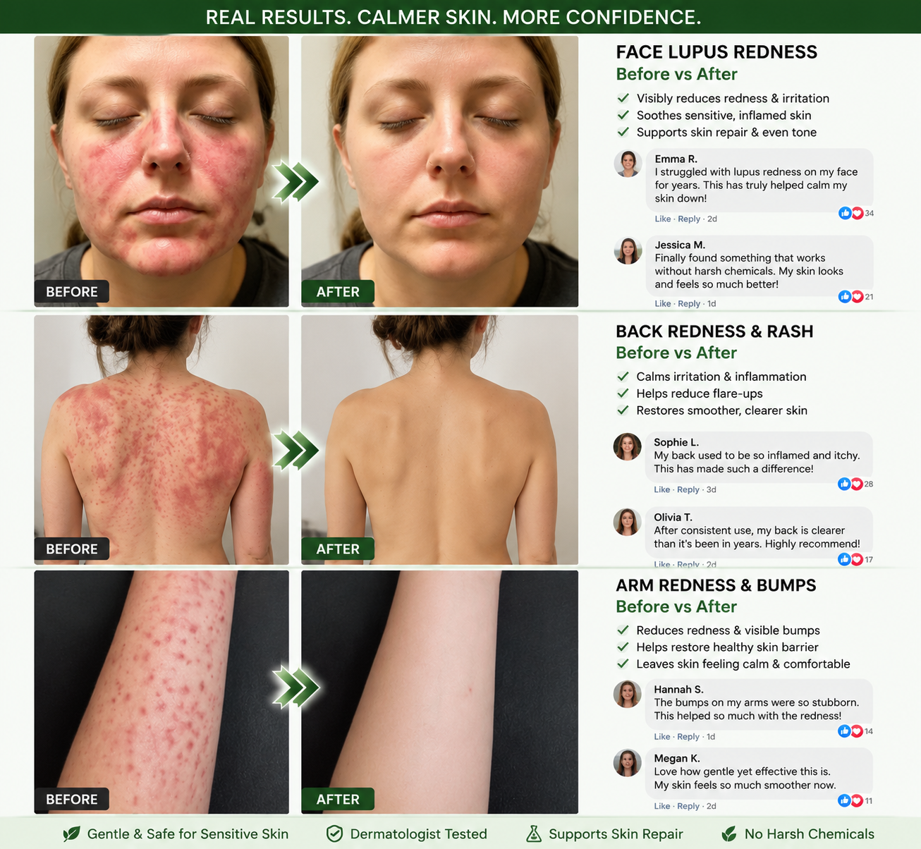 𝗢𝗳𝗳𝗶𝗰𝗶𝗮𝗹 𝘀𝘁𝗼𝗿𝗲  | 𝖲𝗎𝗋𝗀𝗈ᴎɪx® 🍃𝖬𝗈𝗋𝗂𝗇𝗀ɑ · Β𝖾𝗋𝖻𝖾𝗋𝗂𝗇𝖾 & 𝖭𝖠𝖣＋ 10-𝒊𝒏-1 𝑨𝒅𝒗ɑ𝒏𝒄𝒆𝒅 𝑵ɑ𝒏𝒐 𝑴𝒊𝒄𝒓𝒐𝒏𝒆𝒆𝒅𝒍𝒆 𝑷ɑ𝒕𝒄𝒉  𝑪𝒐𝒎𝒃ɑ𝒕 𝒐𝒃𝒆𝒔𝒊𝒕𝒚, 𝒔ɑ𝒈𝒈𝒊𝒏𝒈 𝒔𝒌𝒊𝒏, 𝒅𝒊ɑ𝒃𝒆𝒕𝒆𝒔, 𝒔𝒍𝒆𝒆𝒑 ɑ𝒑𝒏𝒆ɑ, 𝒋𝒐𝒊𝒏𝒕 𝒊𝒔𝒔𝒖𝒆𝒔 & 𝒎𝒐𝒓𝒆🐟️