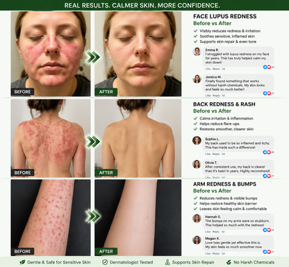 𝗢𝗳𝗳𝗶𝗰𝗶𝗮𝗹 𝘀𝘁𝗼𝗿𝗲  | 𝖲𝗎𝗋𝗀𝗈ᴎɪx® 🍃𝖬𝗈𝗋𝗂𝗇𝗀ɑ · Β𝖾𝗋𝖻𝖾𝗋𝗂𝗇𝖾 & 𝖭𝖠𝖣＋ 10-𝒊𝒏-1 𝑨𝒅𝒗ɑ𝒏𝒄𝒆𝒅 𝑵ɑ𝒏𝒐 𝑴𝒊𝒄𝒓𝒐𝒏𝒆𝒆𝒅𝒍𝒆 𝑷ɑ𝒕𝒄𝒉  𝑪𝒐𝒎𝒃ɑ𝒕 𝒐𝒃𝒆𝒔𝒊𝒕𝒚, 𝒔ɑ𝒈𝒈𝒊𝒏𝒈 𝒔𝒌𝒊𝒏, 𝒅𝒊ɑ𝒃𝒆𝒕𝒆𝒔, 𝒔𝒍𝒆𝒆𝒑 ɑ𝒑𝒏𝒆ɑ, 𝒋𝒐𝒊𝒏𝒕 𝒊𝒔𝒔𝒖𝒆𝒔 & 𝒎𝒐𝒓𝒆🐟️